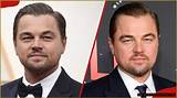 Celebrated Actors with Cleft Lips: Inspiring Stories