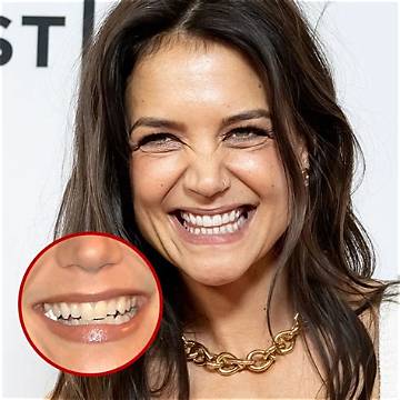 Celebrities with Tooth Gaps: Embracing Unique Smiles