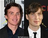 Cillian Murphy and Botox: Is He Natural or Enhanced?
