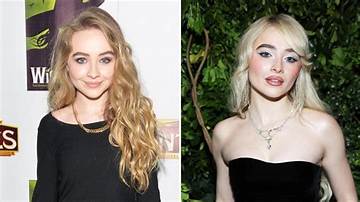 Sabrina Carpenter's Transformation: the Truth About Her Plastic Surgery