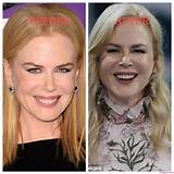 The Truth About Nicole Kidman's Transformation: Did She Get a Nose Job?
