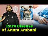 Truth Uncovered: Does the Health of Anant Ambani Raise Concerns?