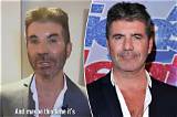 Uncovering Simon Cowell's Disability: a Personal Journey